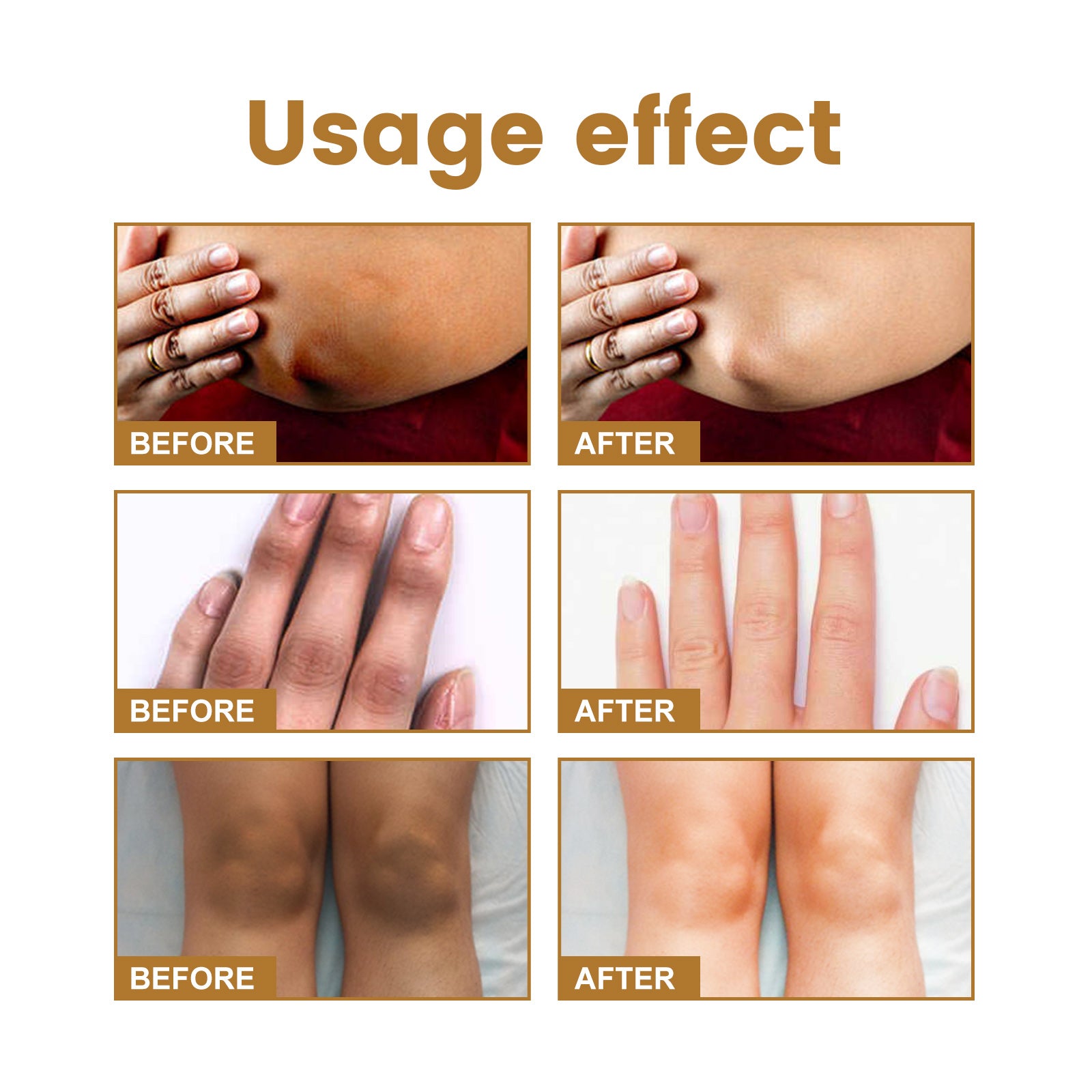 Jaysuing Knuckle Acanthosis Melanin Whitening Serum For Hand And Joint Skin