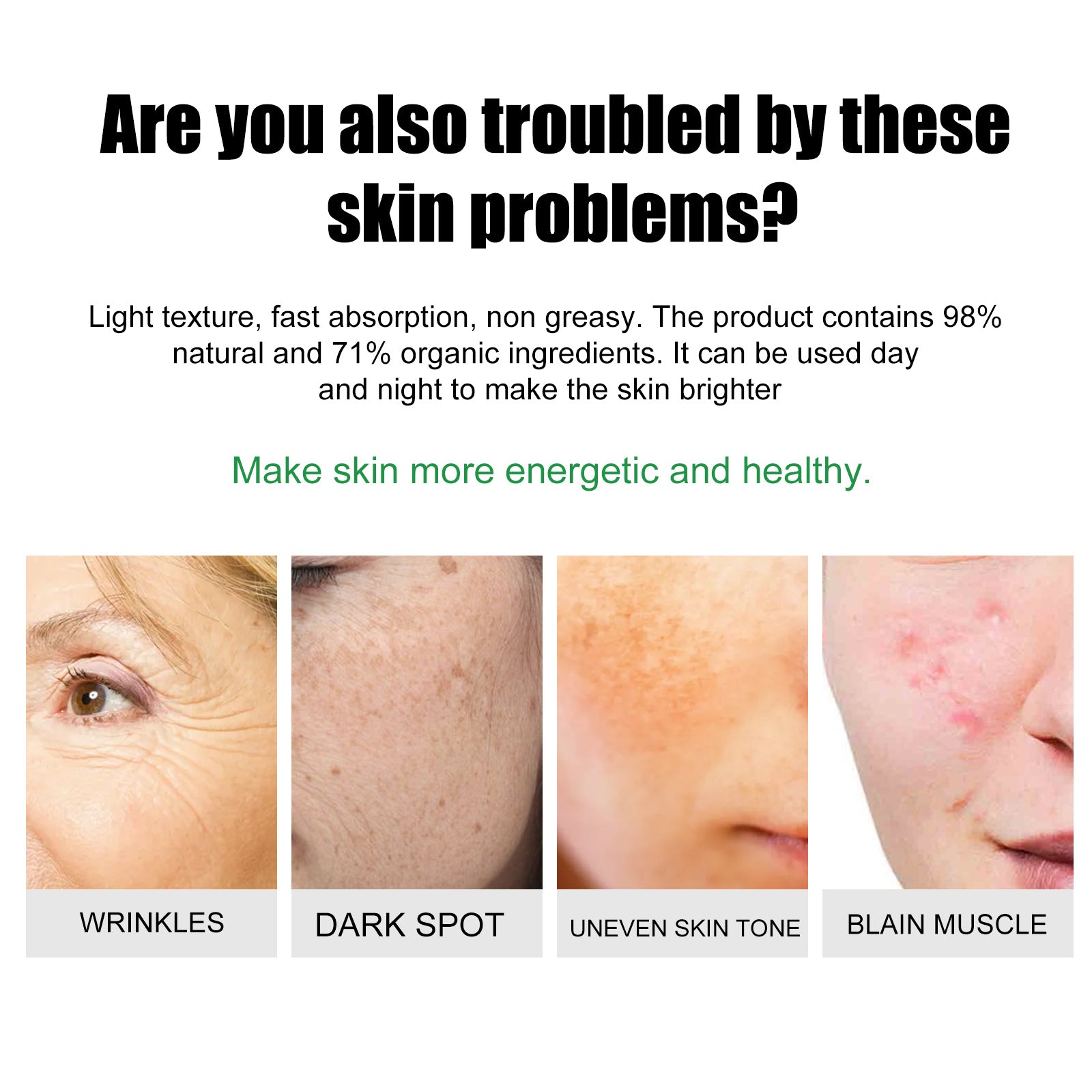 EELHOE Skin Care Cream Improves Dull Skin, Moisturizes Skin, Brightened Skin Care Cream And Clears Acne
