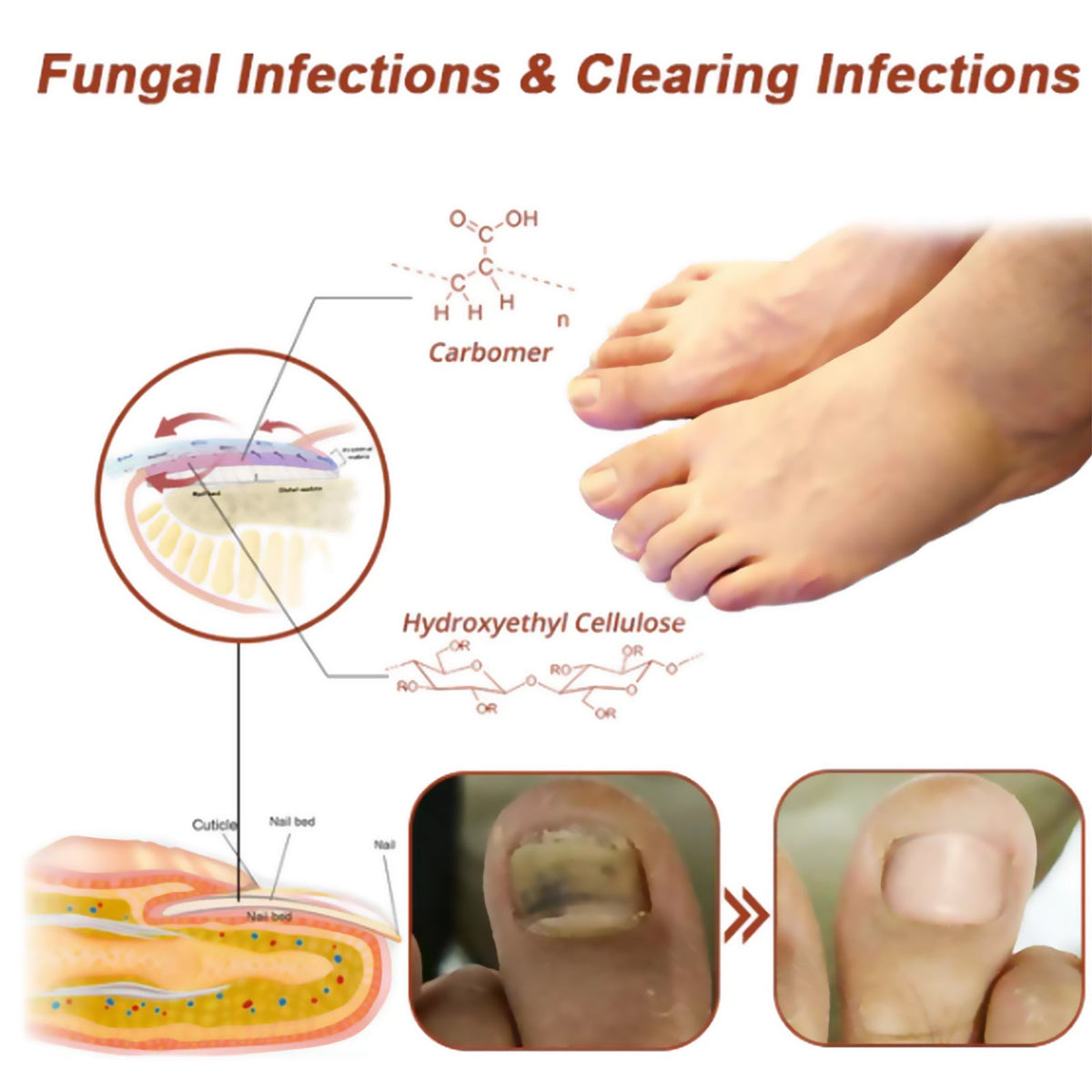 South Moon Nail Care Phototherapy Device, Repair Hands And Feet Gray Nails Yellow Ingrown Nail Soft Nail Care